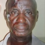 Delta Police, Brutalize, Inflicts Injury On Driver