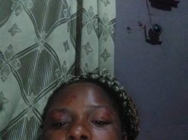 DOMESTIC ABUSE: Woman Narrates Ordeal In Husband’s Hands